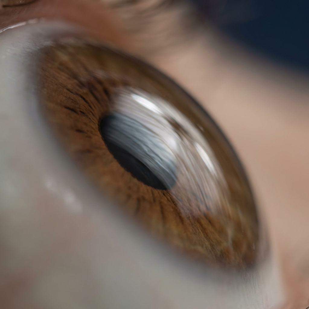Toric IOL astigmatism